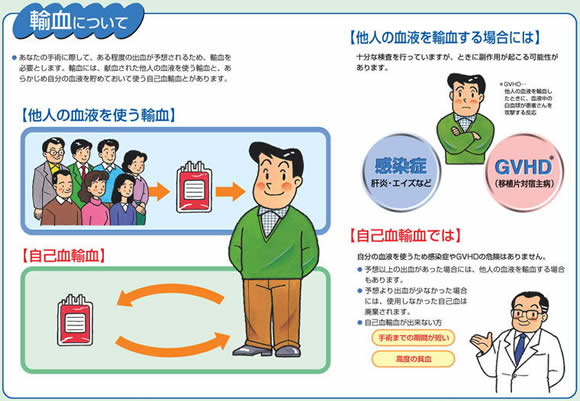輸血について