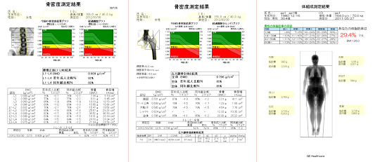 骨密度結果