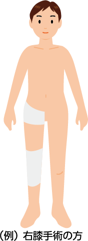 右膝手術の方